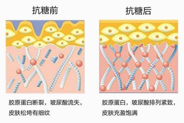 抗糖＝抗衰老？不要等到皮肤长皱纹，才开始抗衰