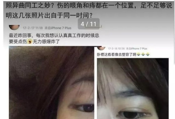 许凯被家暴事件是怎么回事 许凯被女朋友家暴事件始末来龙去脉