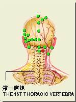 天柱穴的位置