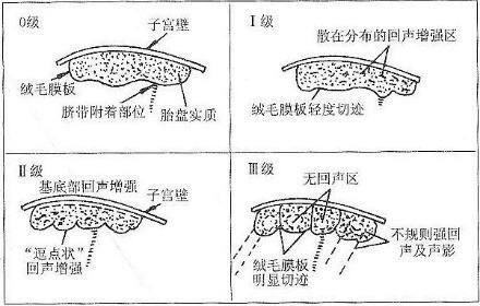 胎盘成熟度 你知道是什么意思吗？