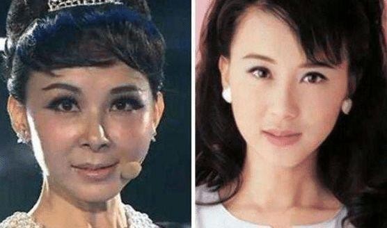 5位整容失败的女星，第2位堪比毁容，最后一位直接成大妈