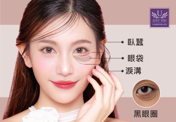 如何区分眼袋、卧蚕、泪沟、黑眼圈？
