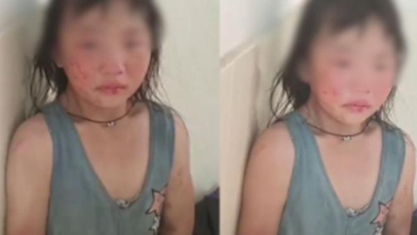 小女孩被后妈虐打到遍体鳞伤，逃至邻居家哭，警方回应来了