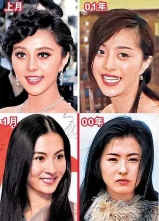 明星整容 明星