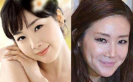 韩国明星整容失败：韩国整容失败的女明星（图）