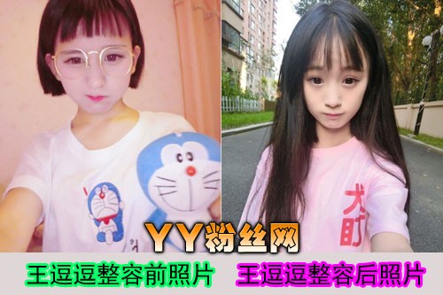 王逗逗整容前后照片对比素颜照 王逗逗和周子昂分手真相家庭背景