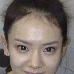 戚薇李承铉拒绝婚前性行为被爆 戚薇整容前后差别惊人