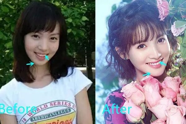 金晨整容前后照片 和邓伦分手后发展一年不如一年后悔过吗