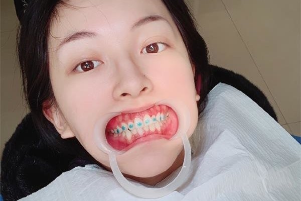 张凯毅怎么那么有钱 美妆博主中唱歌最好听的性格也带劲