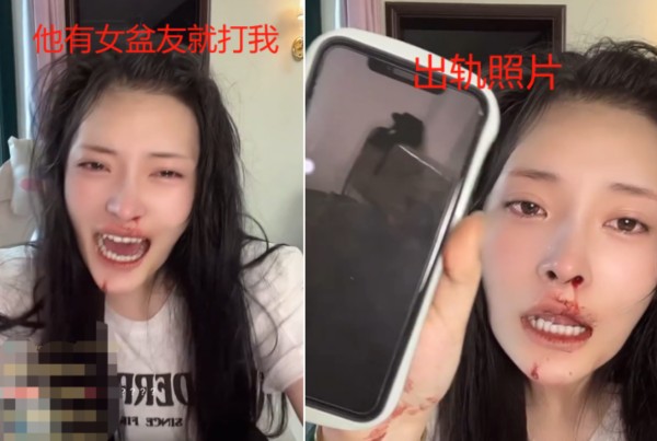 刘叉叉团队大琳被小辉家暴事件是什么情况 大琳小辉家暴发生什么事情了