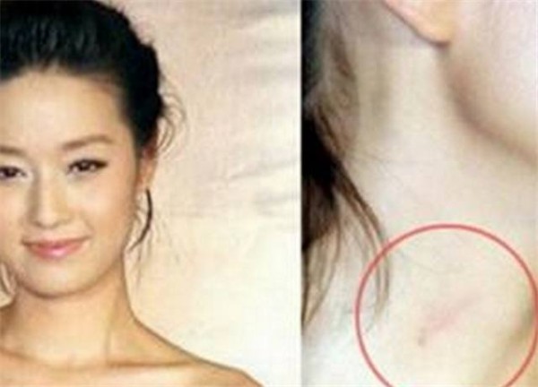 3位女星坐豪车出席活动，被拍到吻痕，林志玲装傻，董卿太明显！
