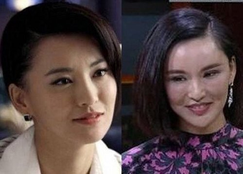 莫小棋是不是整容了 莫小棋整容前后照片