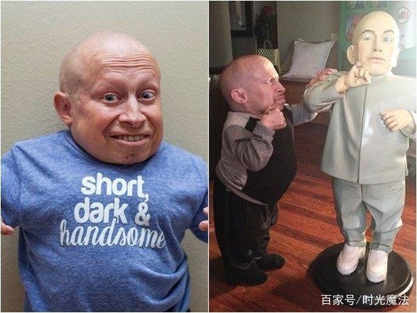 身高81公分的著名男星逝世！这次 他没有战胜外界敌意……