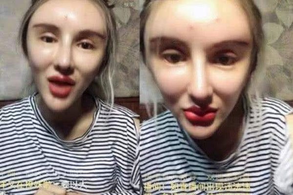 桃花宝宝是男是女 网络女主播从整容到切除子宫