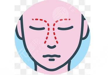 上海九院刘凯做鼻子怎么样