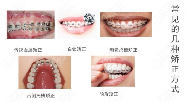 恒伦五一路总院整牙比较好的医生
