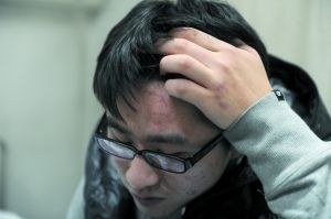 黄亮额头有红肿