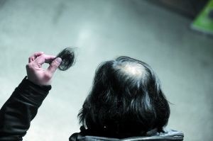 司机刘师傅自称被人揪下头发