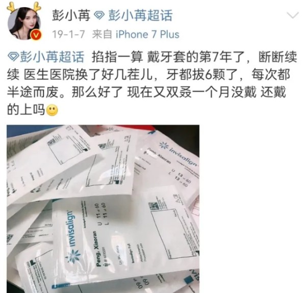 彭小苒是不是整容呀前后对比照，彭小苒整容黑历史扒皮