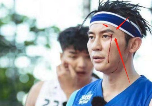 赵丽颖综艺玩游戏被撞飞，李晨眼缝三针，他倒地以后再也起不来