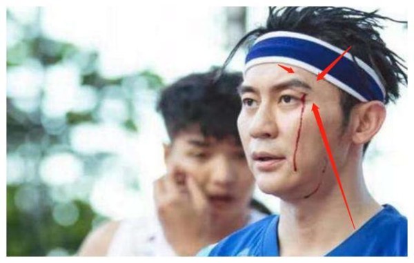 综艺节目有多危险？赵丽颖被撞飞，李晨眼缝三针，他去世观众大笑