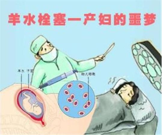 刘强东妹妹因羊水栓塞去世，作为产妇“噩梦”的它到底有多可怕？
