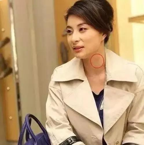 明星吻痕暴露恋情：唐嫣最尴尬，高圆圆最明显 网友：好羡慕！！
