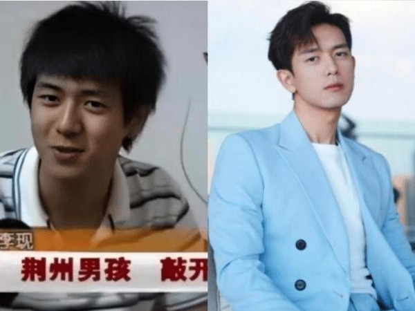明星出道前的照片，简直“惨不忍睹”，网友：论包装的重要性