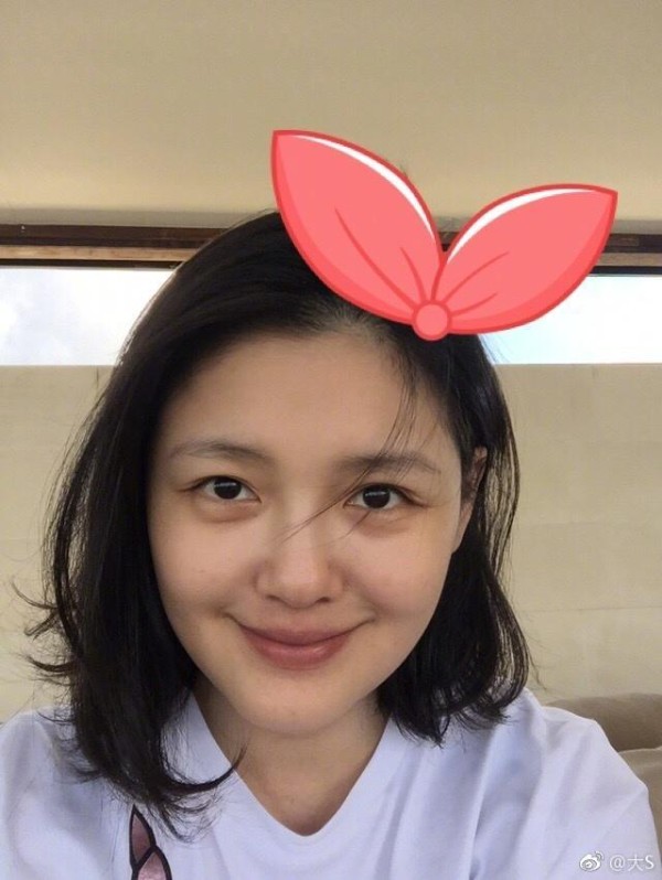 大S晒素颜回应脸肿，就算没打美容针还是胖到不敢认！