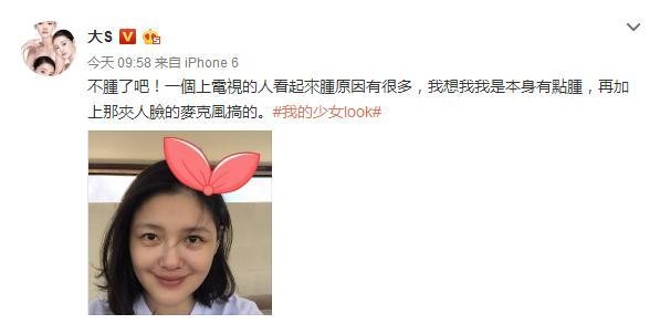 大S晒素颜回应脸肿，就算没打美容针还是胖到不敢认！