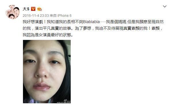 大S晒素颜回应脸肿，就算没打美容针还是胖到不敢认！