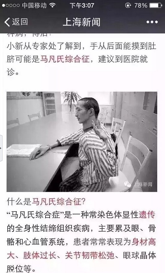 LOL明星摸肚脐 网友关心伊芙蕾雅D罩杯