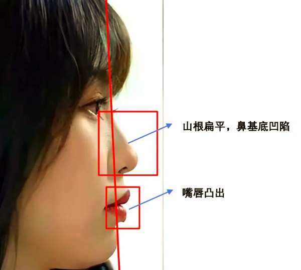 女演员虞书欣的颜值与实力：从《永夜星河》看长相的重要性