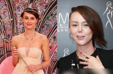 明星整容失败，好的成了“蛇精脸”，失败的真是让人窒息​