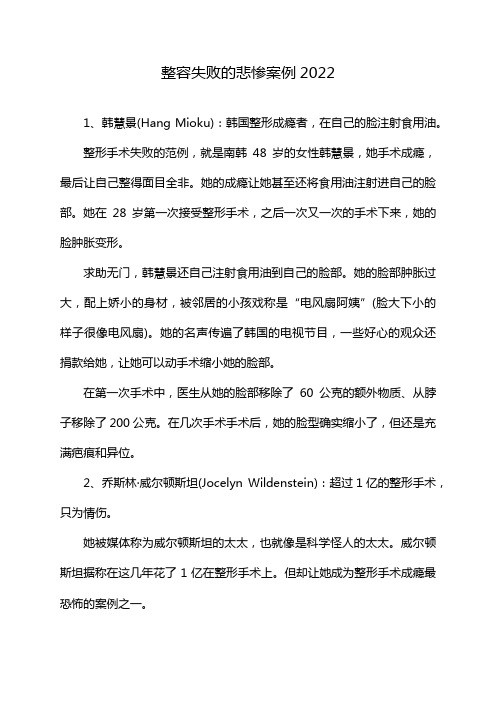 明星整容失败案例