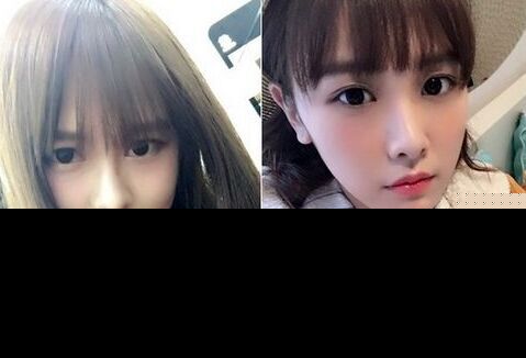 唐安琪发文 SNH48唐安琪近况如何？唐安琪被烧伤事件真相曝光（2）