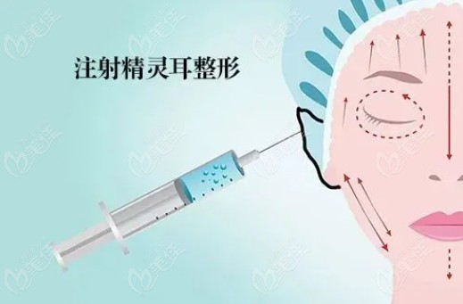 精灵耳注射玻尿酸就可以236z.com
