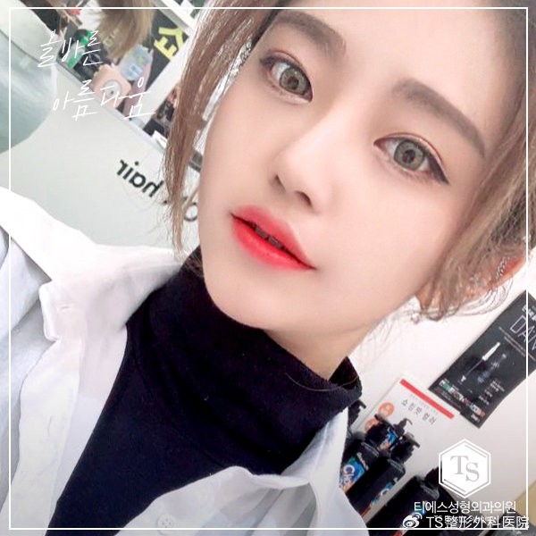 韩国TS解析:最近备受关注的整容趋势，INS名人们华丽的眼鼻线条