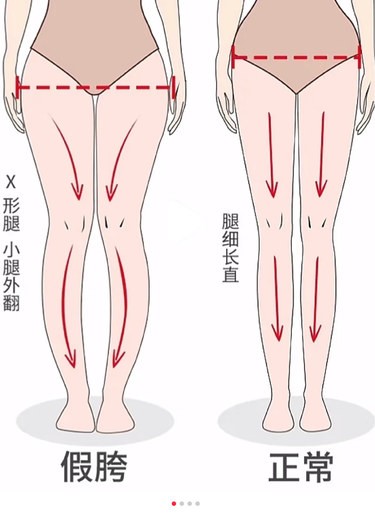 每天五分钟，远离大象腿