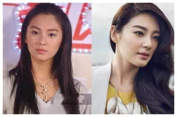 盘点单眼皮变双眼皮的八大明星，你最羡慕谁？