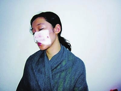 女星被藏獒咬。东南快报