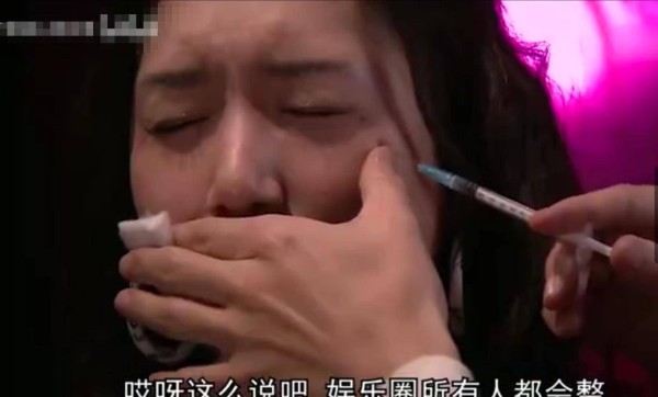 整容科医生采访信息量大！高圆圆成整容模板，某金马影后常去除皱