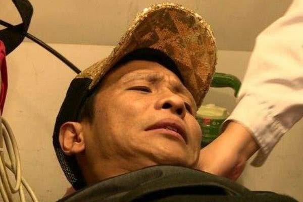 上综艺节目受伤的明星：乐嘉蛋碎，王宝强断腿，最后不幸一位身亡