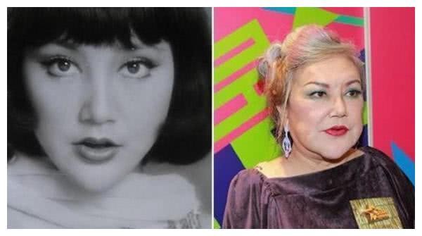 直击：整容失败惨被毁容的5大女星，网友：最后一位面目全非！