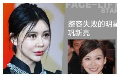 直击：整容失败惨被毁容的5大女星，网友：最后一位面目全非！