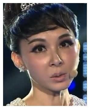 直击：整容失败惨被毁容的5大女星，网友：最后一位面目全非！