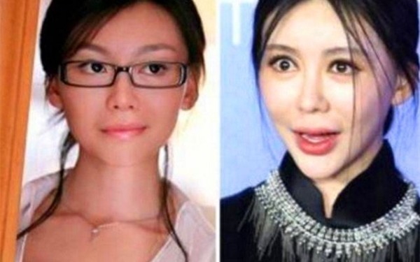 整容失败的7位女星：第一位成“反面教材”，最后一位非常可惜