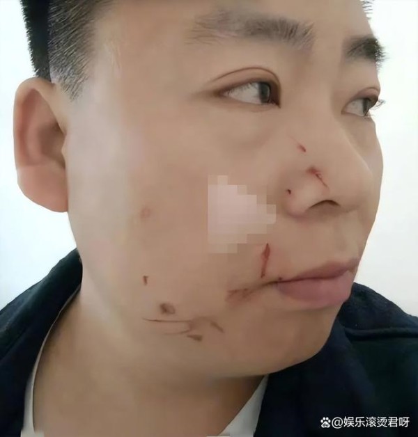 迪丽热巴被恶意p亲密视频 男子合成迪丽热巴视频是否属于性骚扰