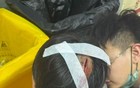 消费者投诉：小朋友在西贝用餐被割破后脑勺缝了6针