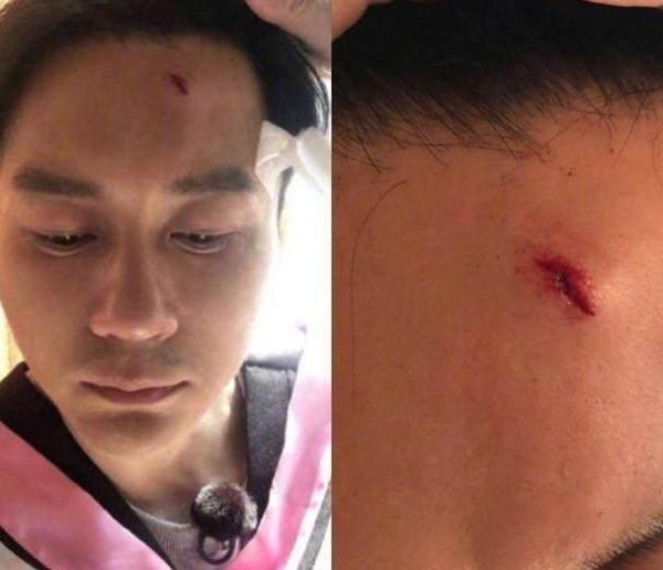 盘点综艺节目受伤的明星，王宝强脚骨折，孟非蛋碎，他当场去世